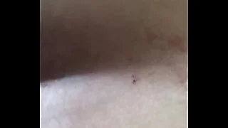 Tore Her Asshole TF Up&comma; Omg This s&period; Felt So Good